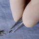 Radioactive “seeds” used in brachytherapy.